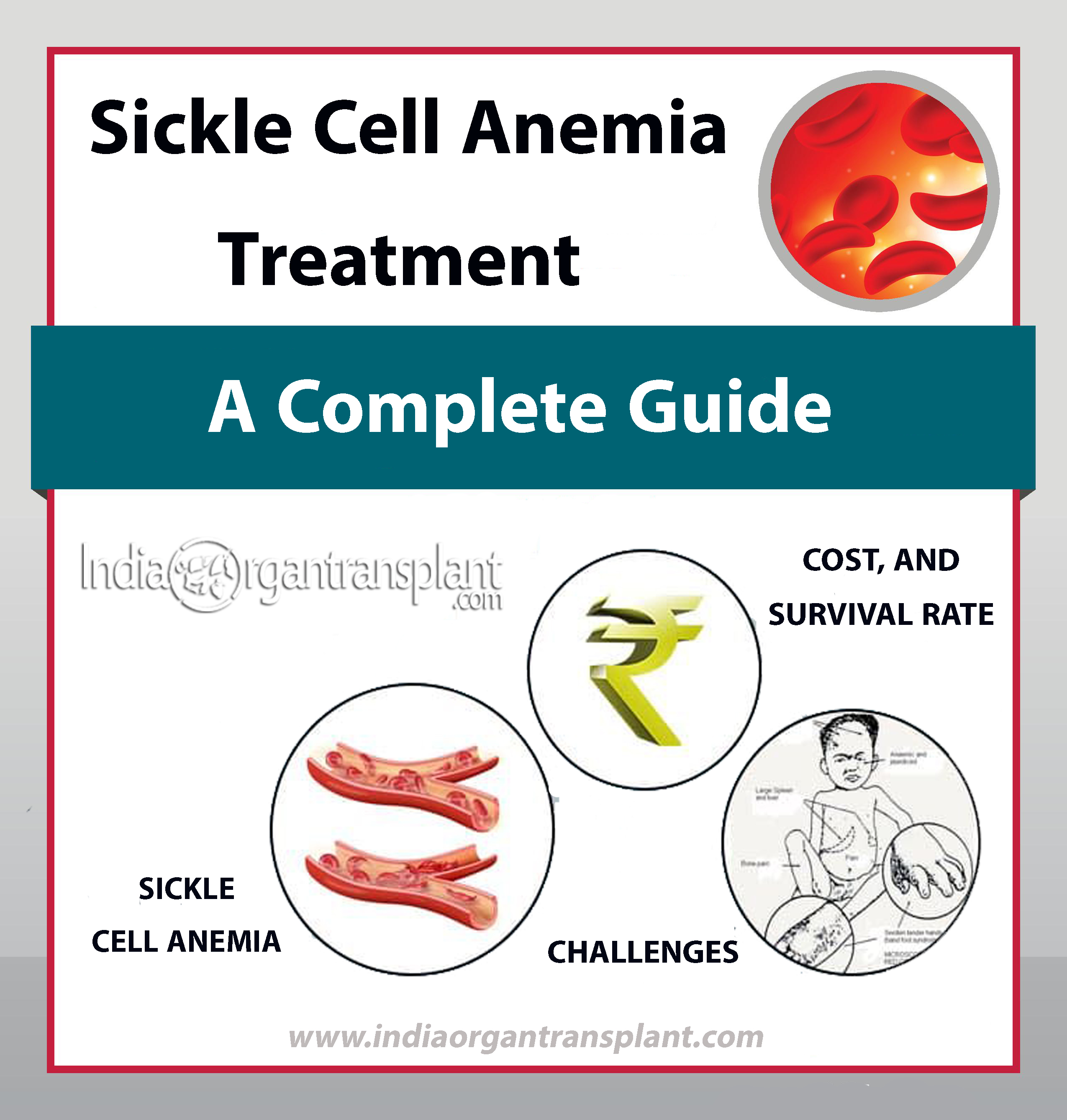 sickle cell symptoms